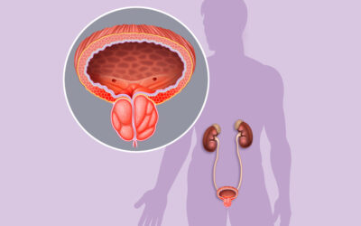 Προστατίτιδα – Μία νόσος με πολλά πρόσωπα