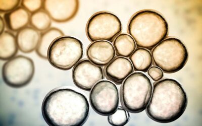 Ουρεόπλασμα: Πώς μεταδίδεται;